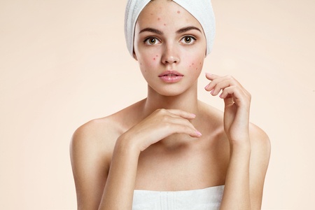 Onzuivere huid- wat doe je er tegen?